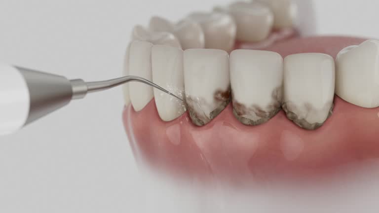 Trusted Dental Crowns And Bridges service in Liberty, IN - Dentist Open Now